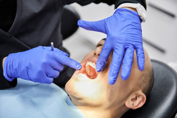Best Knocked-Out Tooth Emergency  in Streator, IL